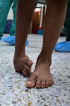 A patient's bare feet standing on a tiled floor