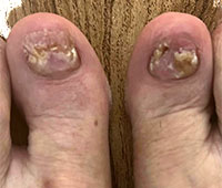 KeryFlex treatment in the San Antonio, TX 78224, Uvalde, TX 78801 and Jourdanton, TX 78026 areas