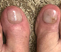 KeryFlex treatment in the San Antonio, TX 78224, Uvalde, TX 78801 and Jourdanton, TX 78026 areas
