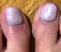 KeryFlex treatment in the San Antonio, TX 78224, Uvalde, TX 78801 and Jourdanton, TX 78026 areas