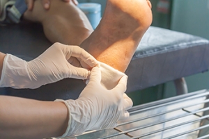 Caring for Diabetic Foot Wounds