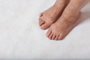 Repairing a Hammertoe