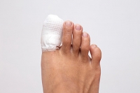 Mild or Severely Broken Toes Are Uncomfortable